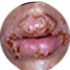 Thmnail
